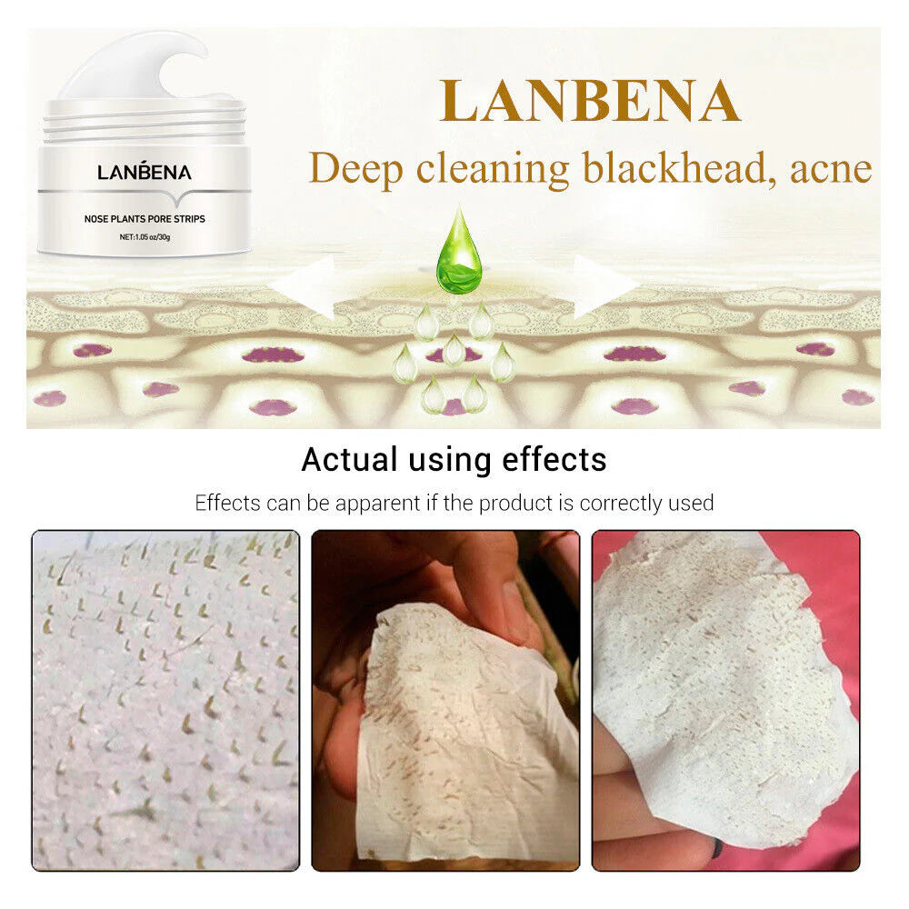 Lanbena Pore Strips