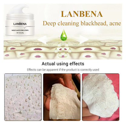 Lanbena Pore Strips